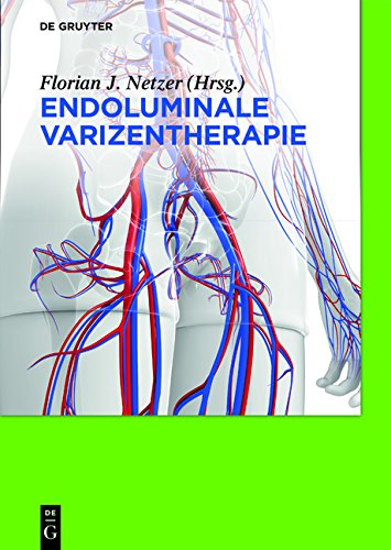 venenfrei Endoluminale Varizentherapie 2015